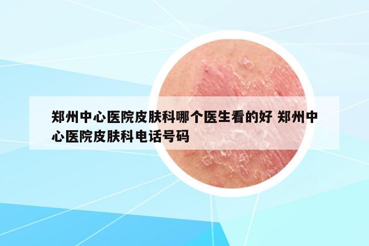 鄭州中心醫(yī)院皮膚科哪個醫(yī)生看的好 鄭州中心醫(yī)院皮膚科電話號碼
