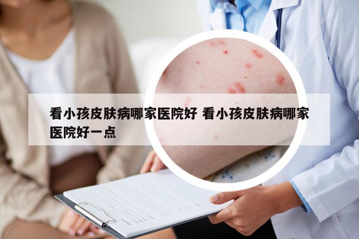 看小孩皮膚病哪家醫(yī)院好 看小孩皮膚病哪家醫(yī)院好一點(diǎn)