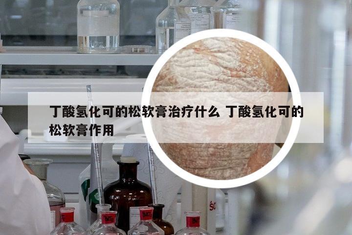 丁酸氫化可的松軟膏治療什么 丁酸氫化可的松軟膏作用