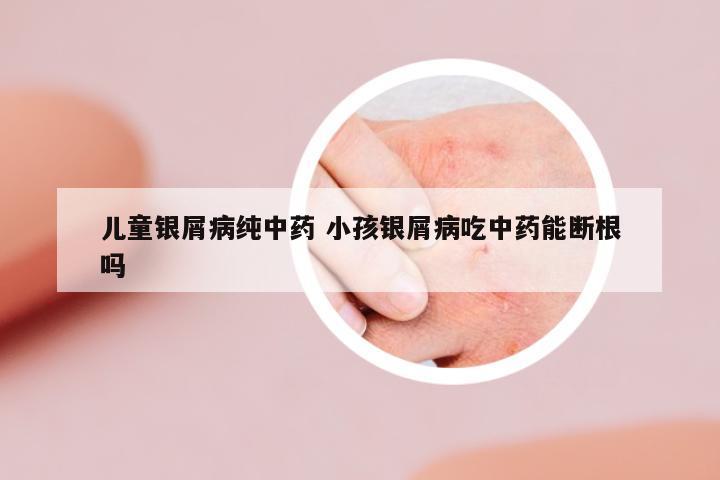 兒童銀屑病純中藥 小孩銀屑病吃中藥能斷根嗎