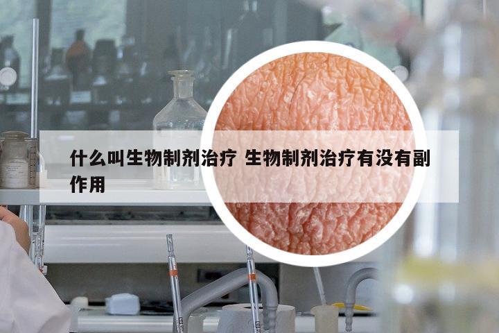 什么叫生物制劑治療 生物制劑治療有沒有副作用