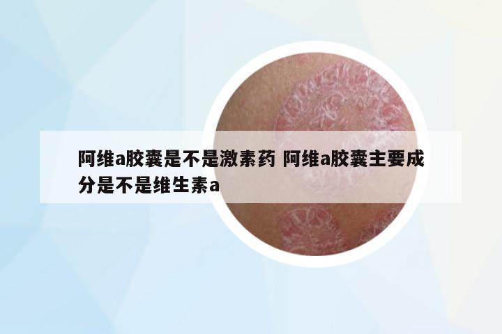 阿維a膠囊是不是激素藥 阿維a膠囊主要成分是不是維生素a