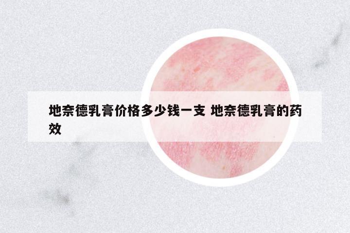 地奈德乳膏價格多少錢一支 地奈德乳膏的藥效