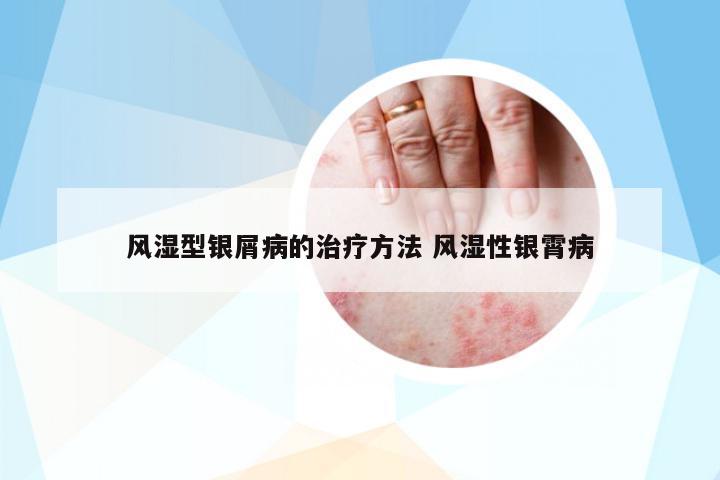風(fēng)濕型銀屑病的治療方法 風(fēng)濕性銀霄病