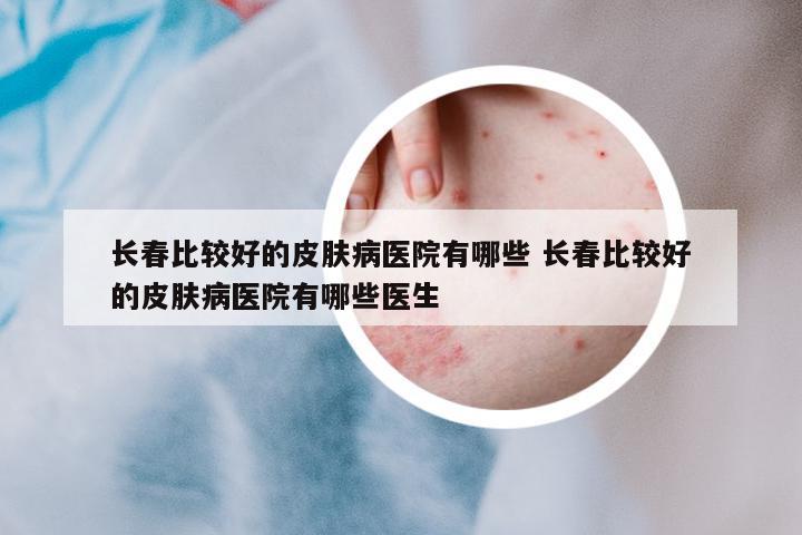 長春比較好的皮膚病醫(yī)院有哪些 長春比較好的皮膚病醫(yī)院有哪些醫(yī)生