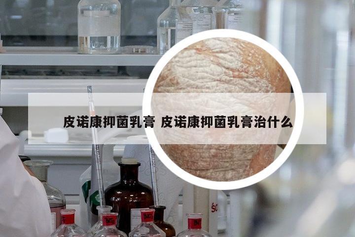 皮諾康抑菌乳膏 皮諾康抑菌乳膏治什么