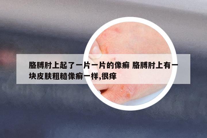 胳膊肘上起了一片一片的像癬 胳膊肘上有一塊皮膚粗糙像癬一樣,很癢