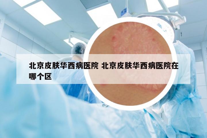北京皮膚華西病醫(yī)院 北京皮膚華西病醫(yī)院在哪個(gè)區(qū)