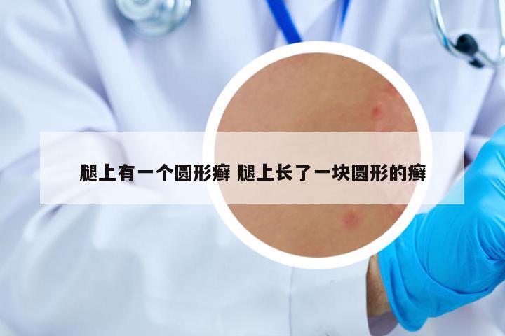 腿上有一個圓形癬 腿上長了一塊圓形的癬