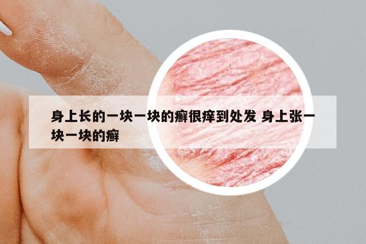 身上長的一塊一塊的癬很癢到處發(fā) 身上張一塊一塊的癬