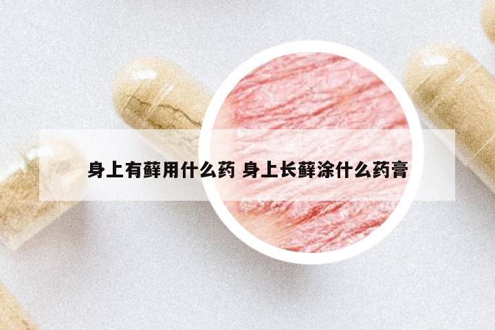 身上有蘚用什么藥 身上長(zhǎng)蘚涂什么藥膏
