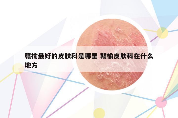 贛榆最好的皮膚科是哪里 贛榆皮膚科在什么地方