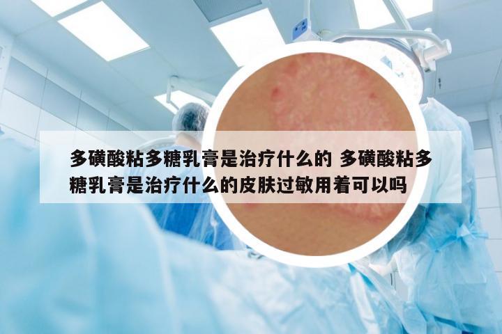 多磺酸粘多糖乳膏是治療什么的 多磺酸粘多糖乳膏是治療什么的皮膚過敏用著可以嗎