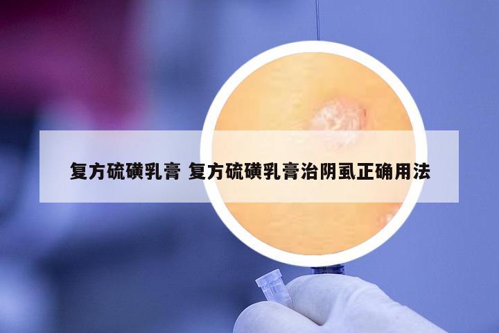 復(fù)方硫磺乳膏 復(fù)方硫磺乳膏治陰虱正確用法
