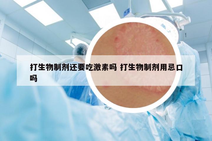 打生物制劑還要吃激素嗎 打生物制劑用忌口嗎