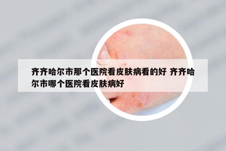 齊齊哈爾市那個醫(yī)院看皮膚病看的好 齊齊哈爾市哪個醫(yī)院看皮膚病好