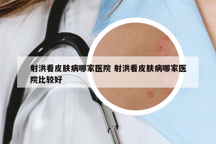 射洪看皮膚病哪家醫(yī)院 射洪看皮膚病哪家醫(yī)院比較好