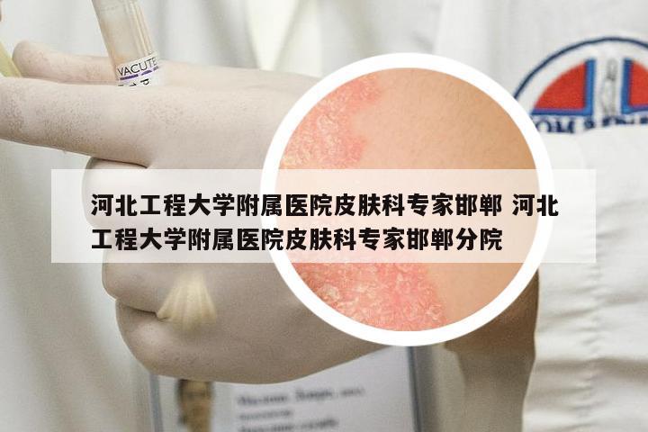河北工程大學(xué)附屬醫(yī)院皮膚科專(zhuān)家邯鄲 河北工程大學(xué)附屬醫(yī)院皮膚科專(zhuān)家邯鄲分院