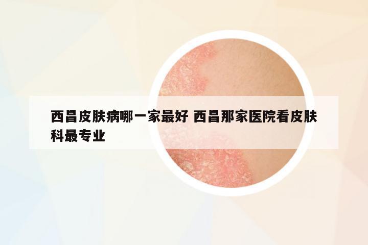 西昌皮膚病哪一家最好 西昌那家醫(yī)院看皮膚科最專業(yè)