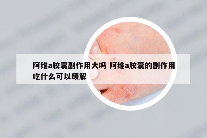 阿維a膠囊副作用大嗎 阿維a膠囊的副作用吃什么可以緩解
