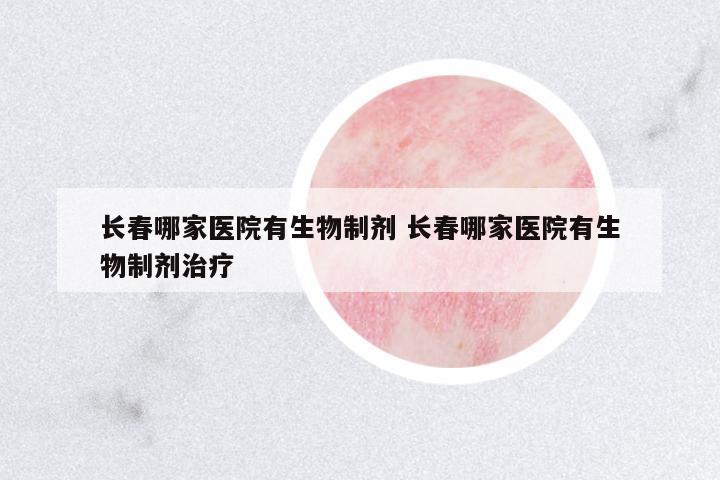 長(zhǎng)春哪家醫(yī)院有生物制劑 長(zhǎng)春哪家醫(yī)院有生物制劑治療