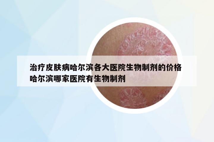 治療皮膚病哈爾濱各大醫(yī)院生物制劑的價(jià)格 哈爾濱哪家醫(yī)院有生物制劑