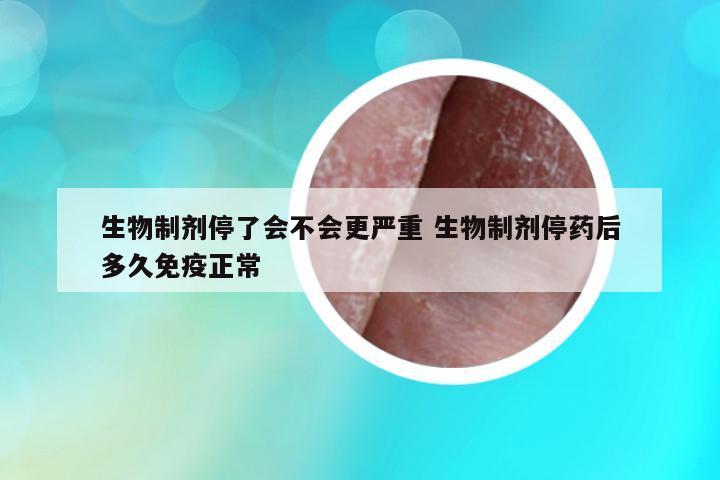 生物制劑停了會不會更嚴(yán)重 生物制劑停藥后多久免疫正常