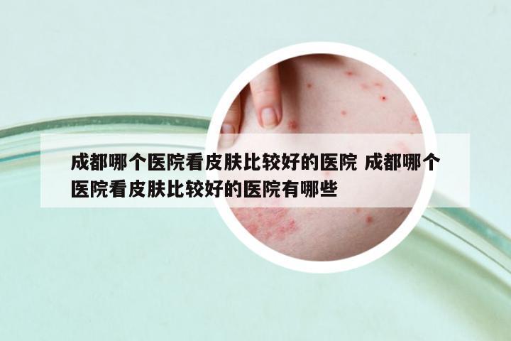 成都哪個(gè)醫(yī)院看皮膚比較好的醫(yī)院 成都哪個(gè)醫(yī)院看皮膚比較好的醫(yī)院有哪些