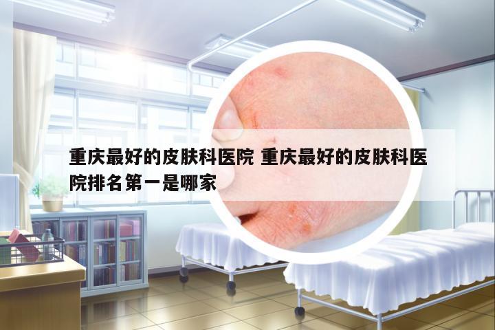重慶最好的皮膚科醫(yī)院 重慶最好的皮膚科醫(yī)院排名第一是哪家