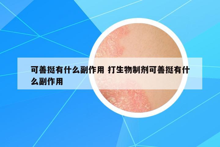 可善挺有什么副作用 打生物制劑可善挺有什么副作用