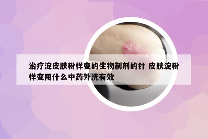 治療淀皮膚粉樣變的生物制劑的針 皮膚淀粉樣變用什么中藥外洗有效