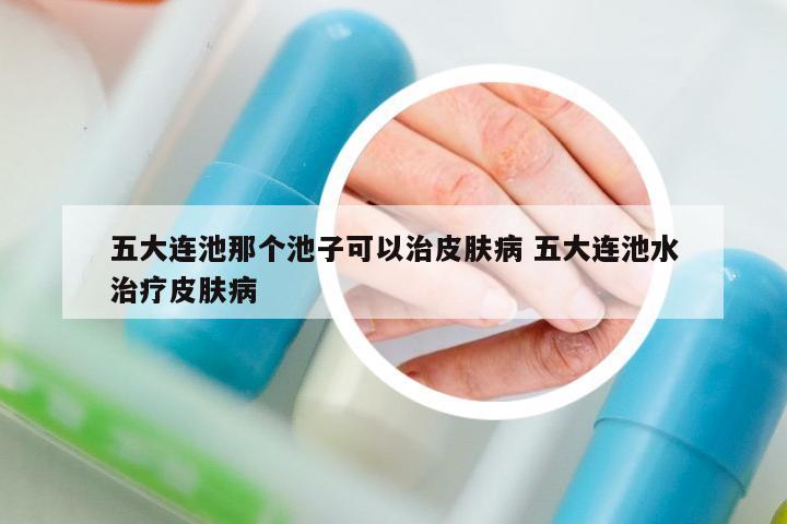 五大連池那個(gè)池子可以治皮膚病 五大連池水治療皮膚病