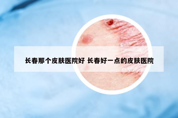 長春那個皮膚醫(yī)院好 長春好一點的皮膚醫(yī)院
