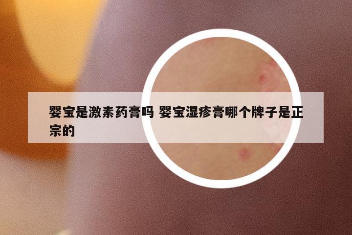 嬰寶是激素藥膏嗎 嬰寶濕疹膏哪個(gè)牌子是正宗的