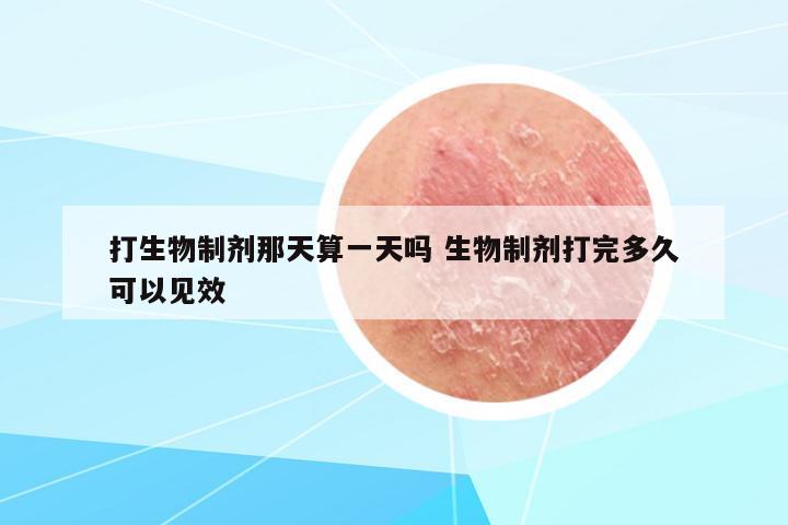 打生物制劑那天算一天嗎 生物制劑打完多久可以見效