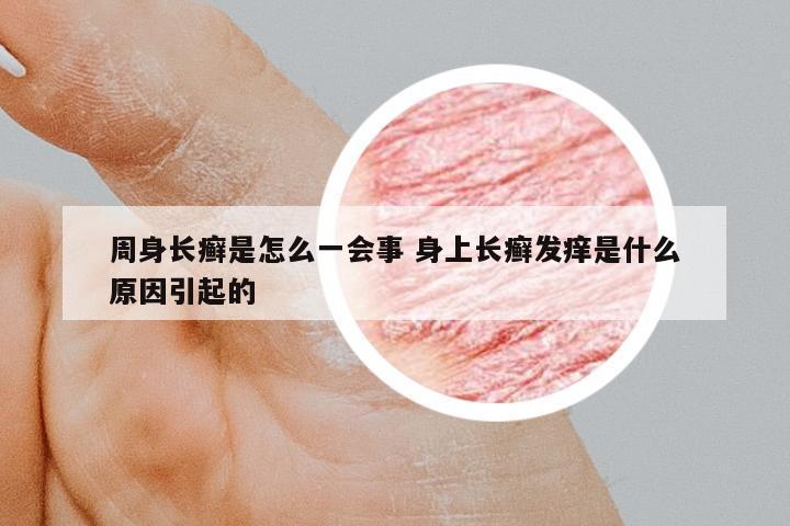 周身長癬是怎么一會事 身上長癬發(fā)癢是什么原因引起的