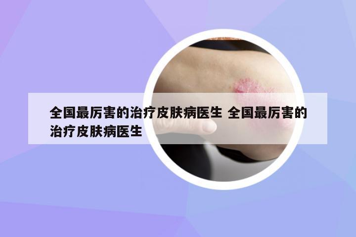 全國最厲害的治療皮膚病醫(yī)生 全國最厲害的治療皮膚病醫(yī)生
