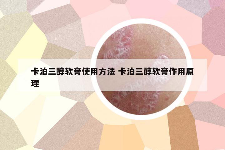 卡泊三醇軟膏使用方法 卡泊三醇軟膏作用原理