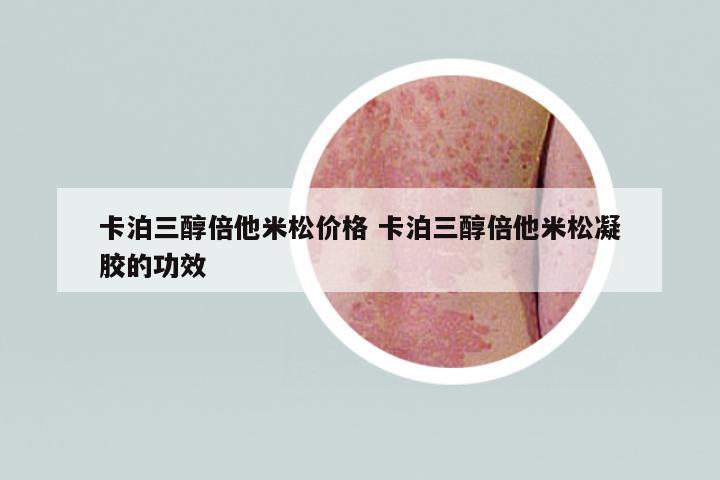 卡泊三醇倍他米松價(jià)格 卡泊三醇倍他米松凝膠的功效