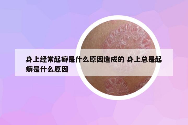 身上經(jīng)常起癬是什么原因造成的 身上總是起癬是什么原因