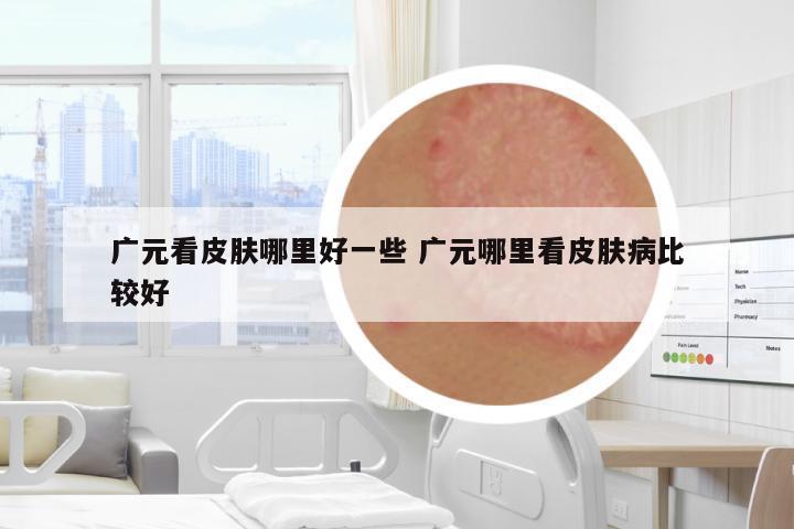 廣元看皮膚哪里好一些 廣元哪里看皮膚病比較好