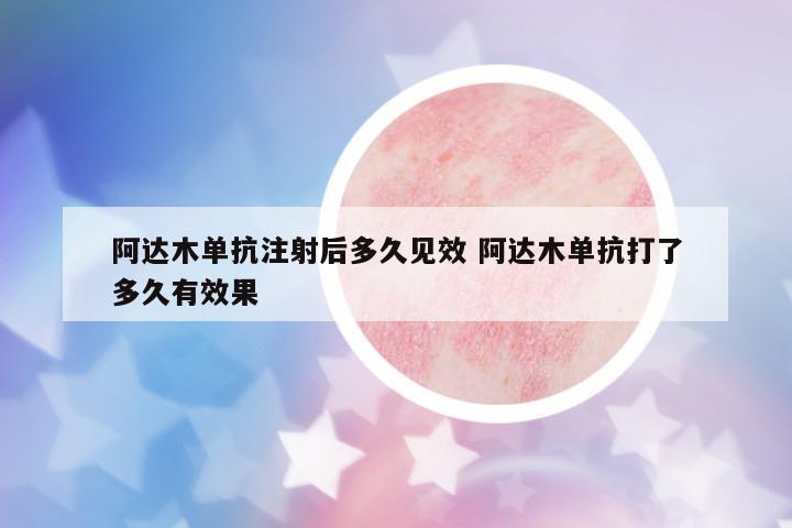 阿達(dá)木單抗注射后多久見效 阿達(dá)木單抗打了多久有效果