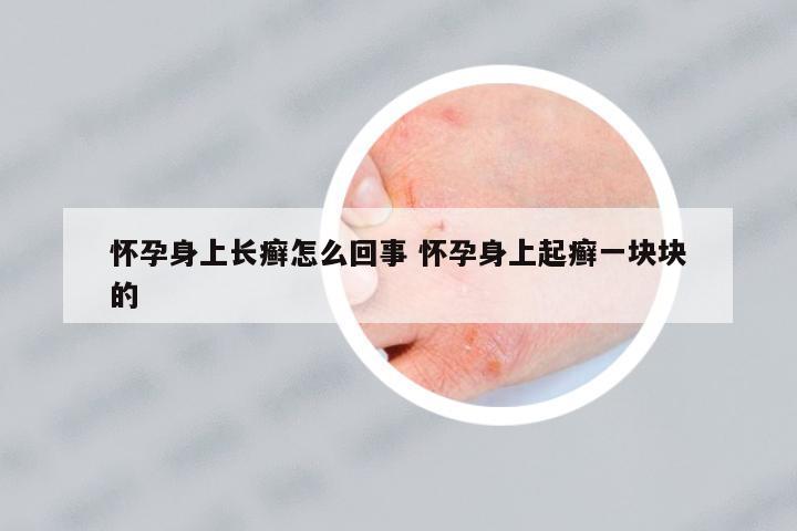 懷孕身上長癬怎么回事 懷孕身上起癬一塊塊的