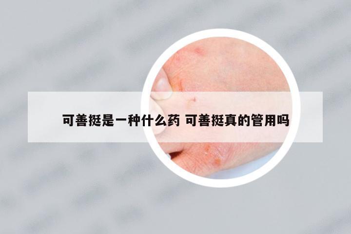 可善挺是一種什么藥 可善挺真的管用嗎