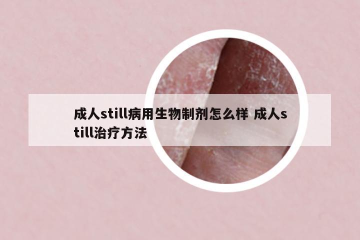 成人still病用生物制劑怎么樣 成人still治療方法