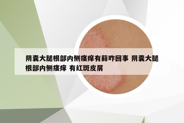 陰囊大腿根部?jī)?nèi)側(cè)瘙癢有蘚咋回事 陰囊大腿根部?jī)?nèi)側(cè)瘙癢 有紅斑皮屑