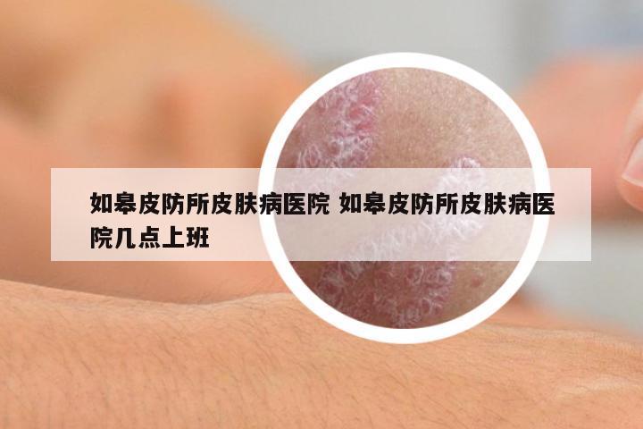 如皋皮防所皮膚病醫(yī)院 如皋皮防所皮膚病醫(yī)院幾點(diǎn)上班
