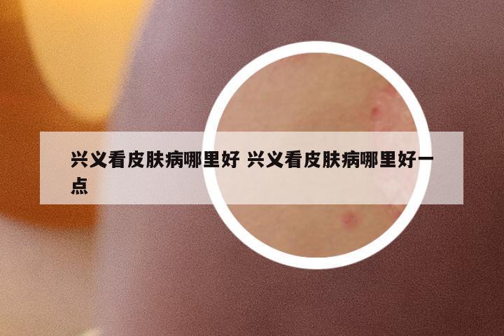 興義看皮膚病哪里好 興義看皮膚病哪里好一點(diǎn)