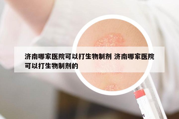 濟(jì)南哪家醫(yī)院可以打生物制劑 濟(jì)南哪家醫(yī)院可以打生物制劑的