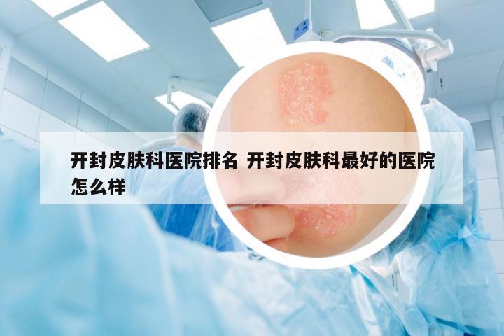 開封皮膚科醫(yī)院排名 開封皮膚科最好的醫(yī)院怎么樣